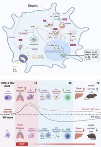Restricting TRIM13 sustains dendritic cell immunity through STING signaling during sepsis.