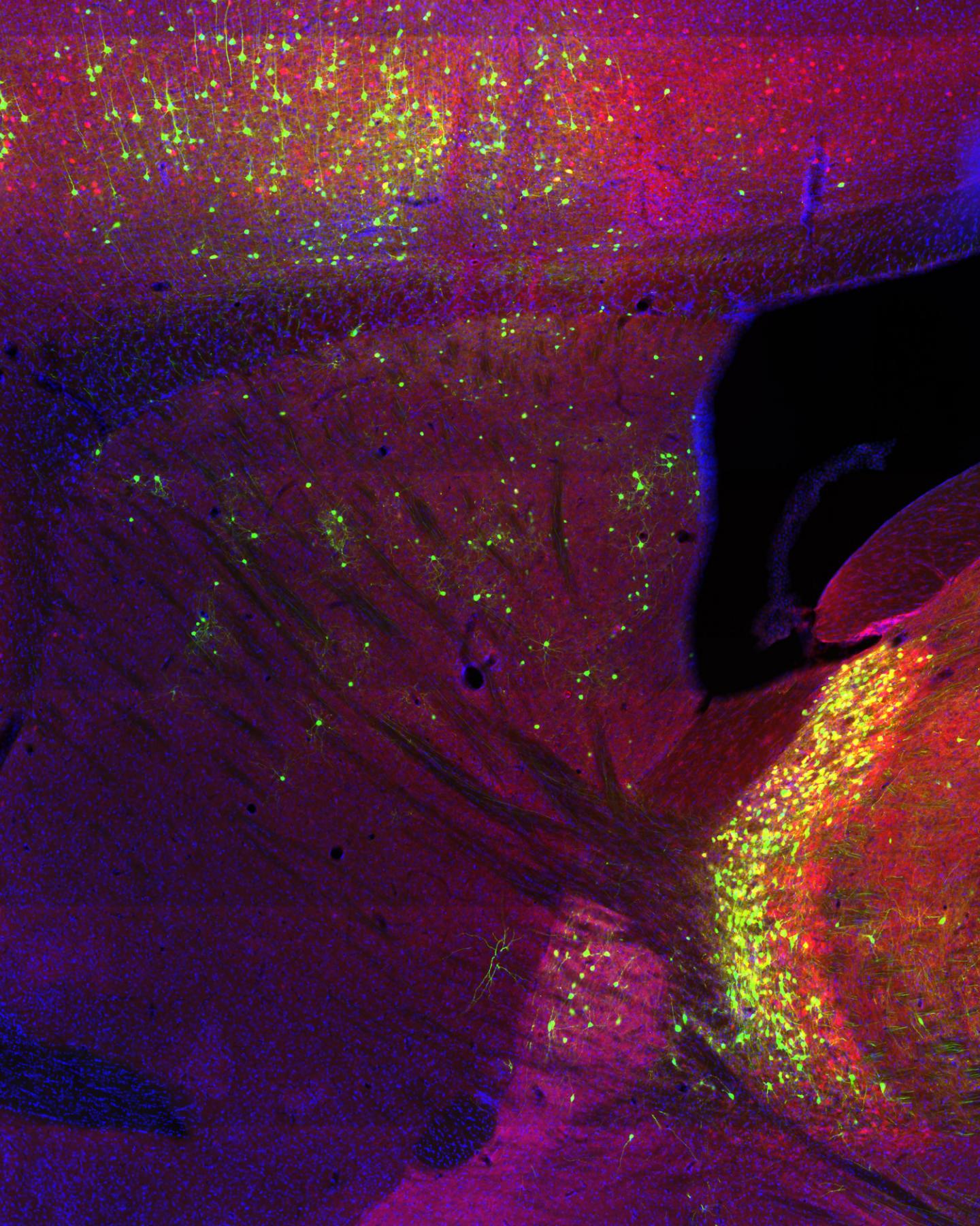 Salk Institute -- Jin Lab -- Interneurons