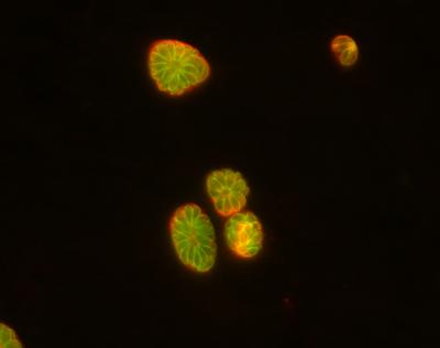 Double-Duty Protein Triggers Parasite Entry and Replication (2 of 2)