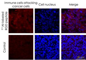 Figure2. Distribution of immune cells in tumor tissues.