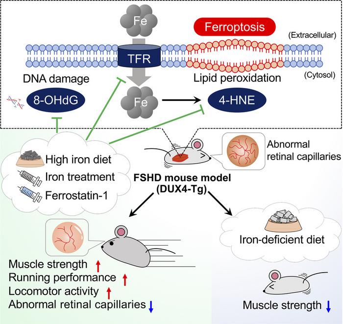 Activation of Ferroptosis Pathways in FSHD