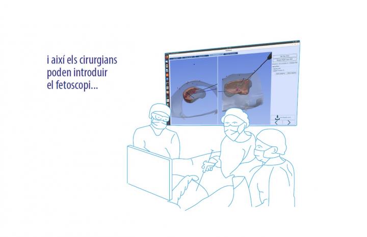 New Surgical GPS 