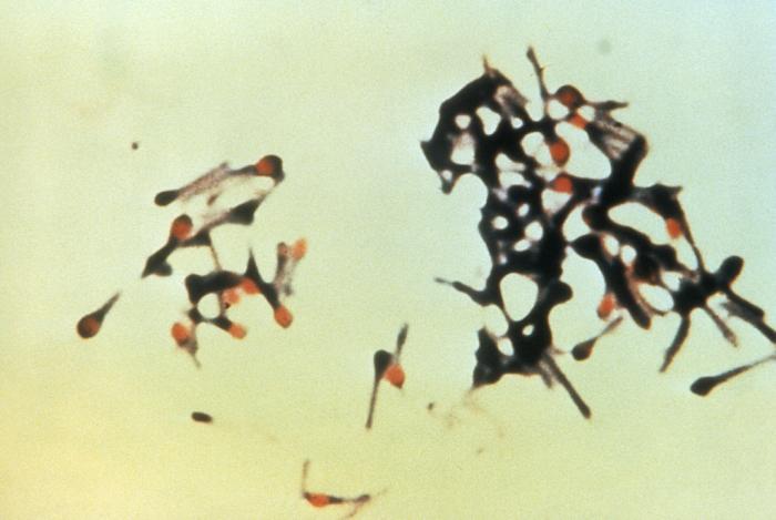 Study Illustrates Challenges of Lowering Tetanus Mortality