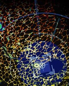 Improving Control of Age-Related Obesity