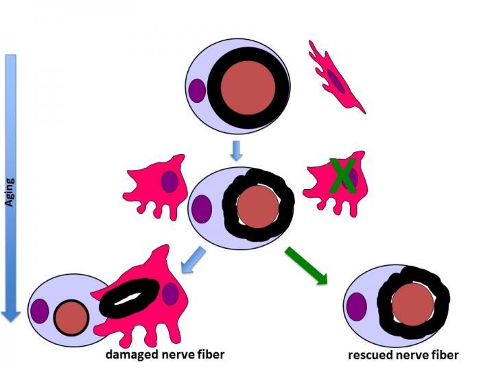 Aging Nerves