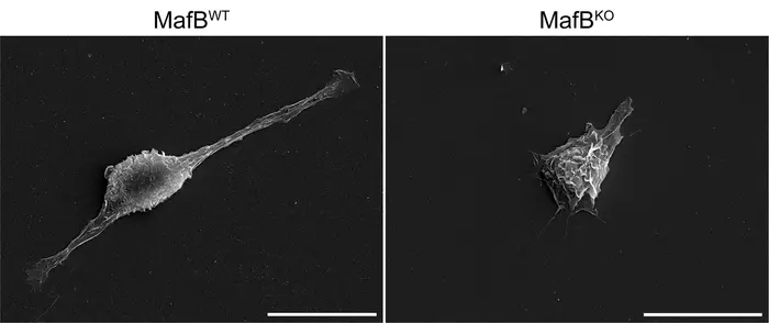 Scanning electron microscopy images of cultured macrophages.