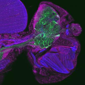 Tissue section through the head of a fruit fly: