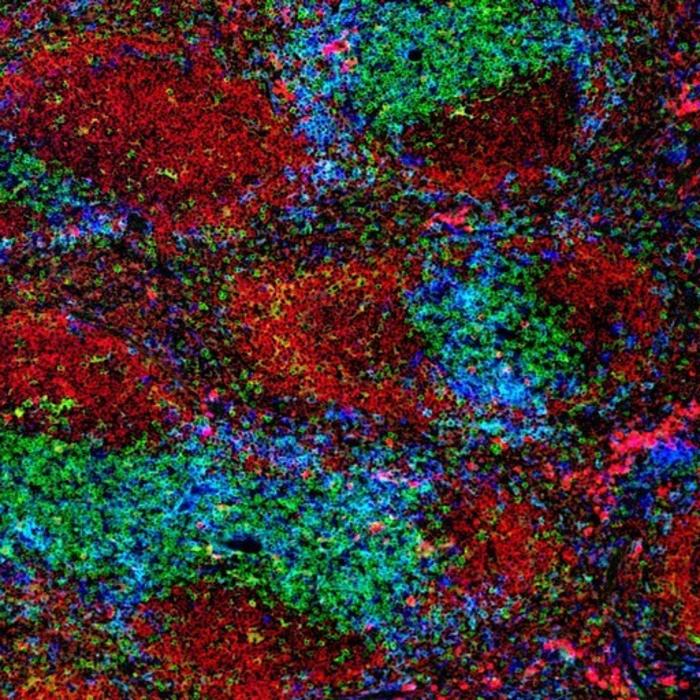 Pulmonary infection patterns in immunocompromised ICU patients