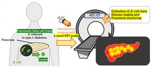 Bringing diabetes treatment into focus