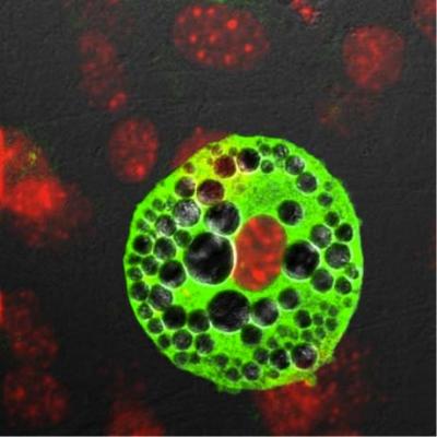 Newly Discovered Human Fat Cell Opens up New Opportunities for Future Treatment of Obesity