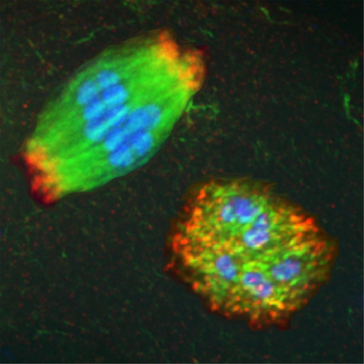 Spindle vs. Microtubule Ball