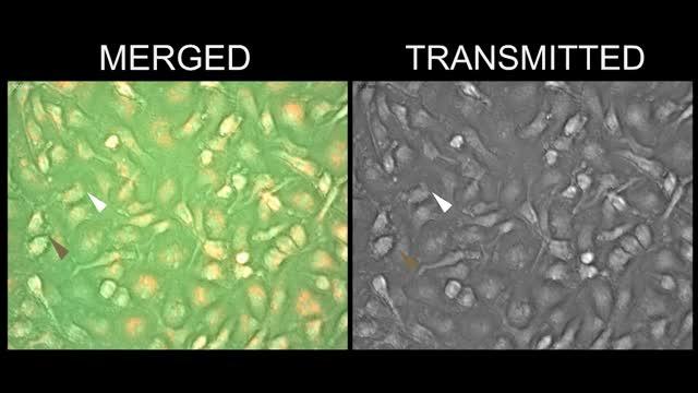 Macrophages Derived from Mice and Infected with the Bacterium <i>Francisella tularensid</i>
