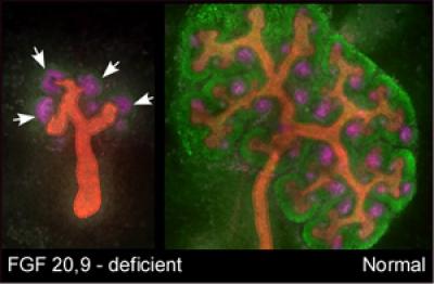 Kidney Development