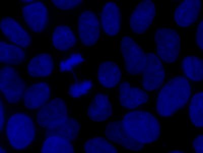 Aneuploidy -- Causes and Consequences (2 of 9)