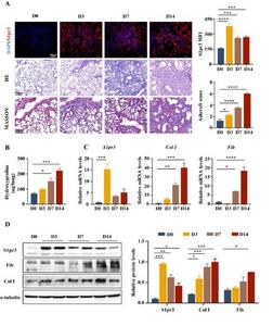 Analysis of S1pr3 expression in the development of BLM-induced pulmonary fibrosis in mice.