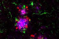 Amyloid, Tau and Microglia