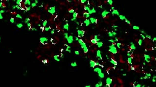 A New Way to Generate Insulin-Producing Cells in Type 1 Diabetes