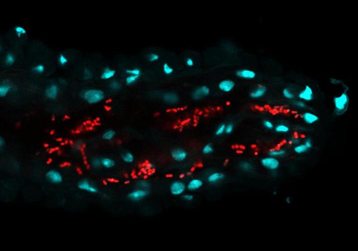 Bacteria in the Gut of Fruit Flies