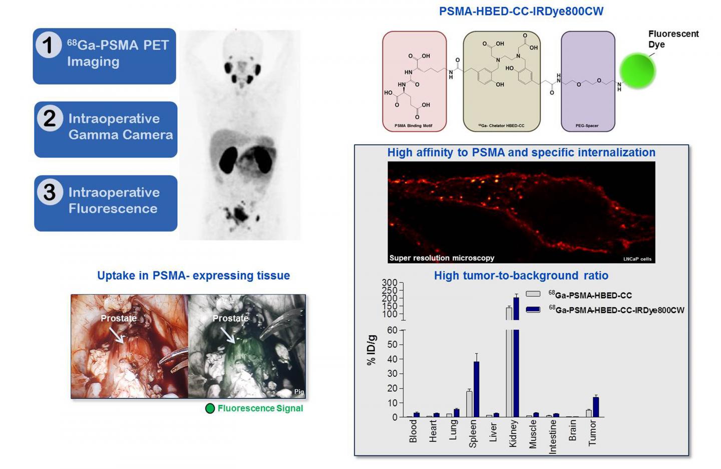 Dual-Labeled PSMA-Inhibitors for the Diagnosis and Therapy of Prostate Cancer