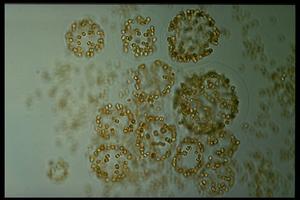 Phaeocystis