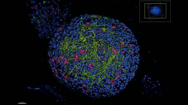 Peeking inside 3D human 'mini-brains' to understand the brain