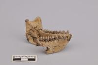 jawbone
