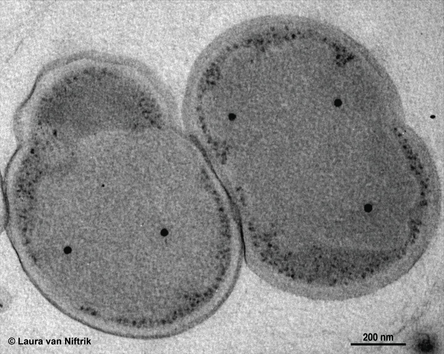 <i>K. stuttgartiensis</i> Under a Transmission Electron Microscope