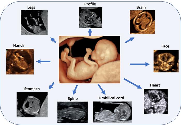 Routine first trimester ultrasounds lead to earlier detection of fetal anomalies