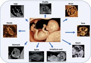 Routine first trimester ultrasounds lead to earlier detection of fetal anomalies