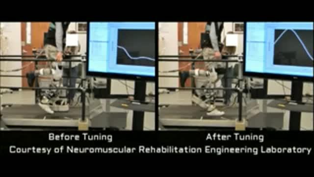 Tech Automatically 'Tunes' Powered Prosthetic Legs