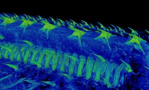 Dorsal denticle