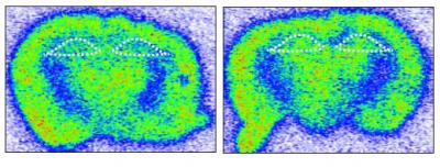 Metabolic Activity in the Hippocampus