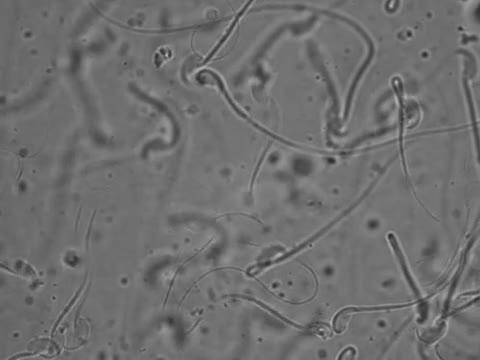 Fast-moving Sperm