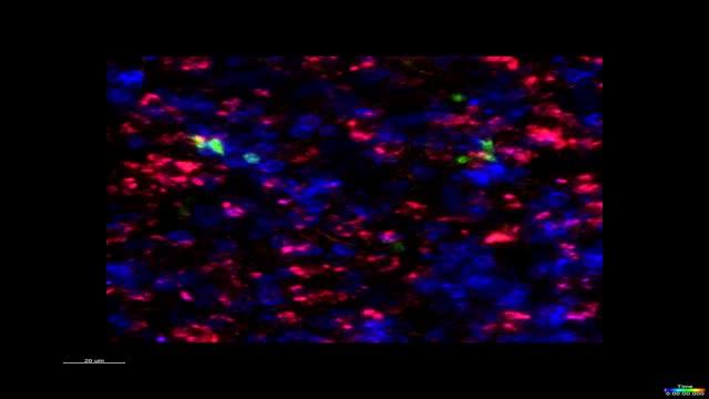 Malaria Immunosuppression