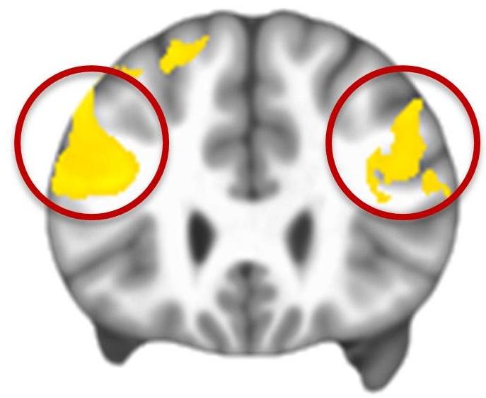 Brain Scan