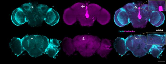Fly's brain under a microscope
