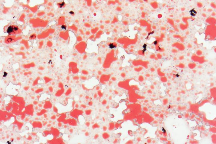 Natural Sugar Defends Against Metabolic Syndrome, in Mice