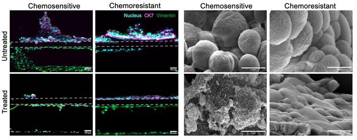 Patient-specific EAC treated on-a-chip