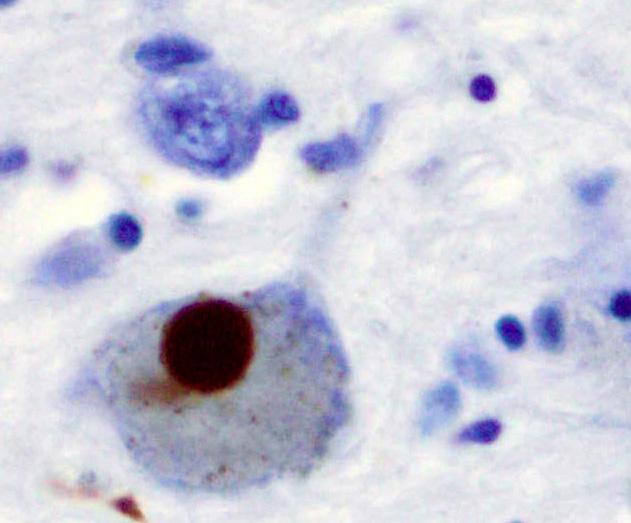 Alpha Syn-Nuclein