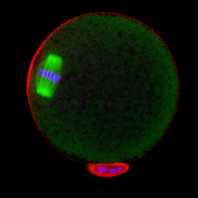 Meiosis II spindle