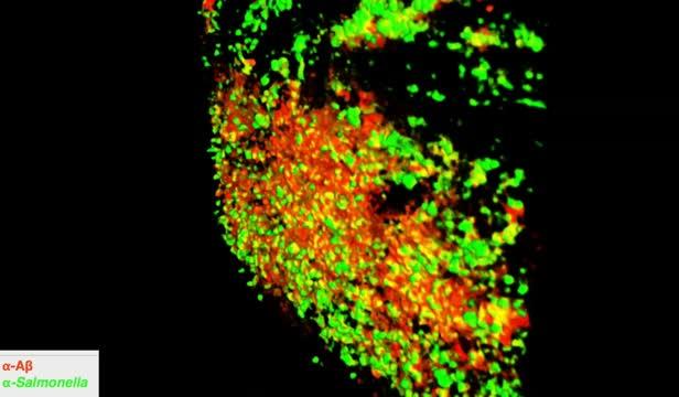 Can Alzheimer's Disease-Associated Peptide Fight Bacterial Infection? (2 of 2)