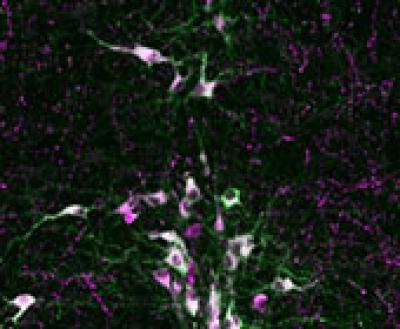 The Role of Serotonin-producing Cells in SIDS