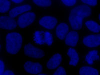 Aneuploidy -- Causes and Consequences (3 of 9)