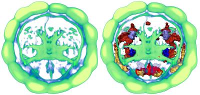 Brain Map of Gene Activity