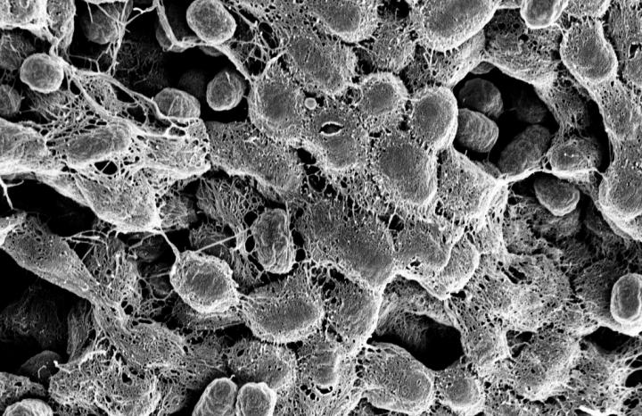 Uti Biofilm