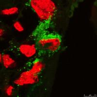 Trophoblast Infected with Zika