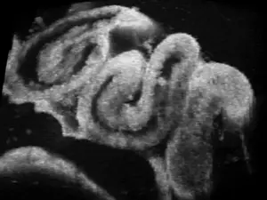 4D in vivo OCT imaging