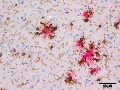 Beta-amyloid Plaques from an AD Mouse Model