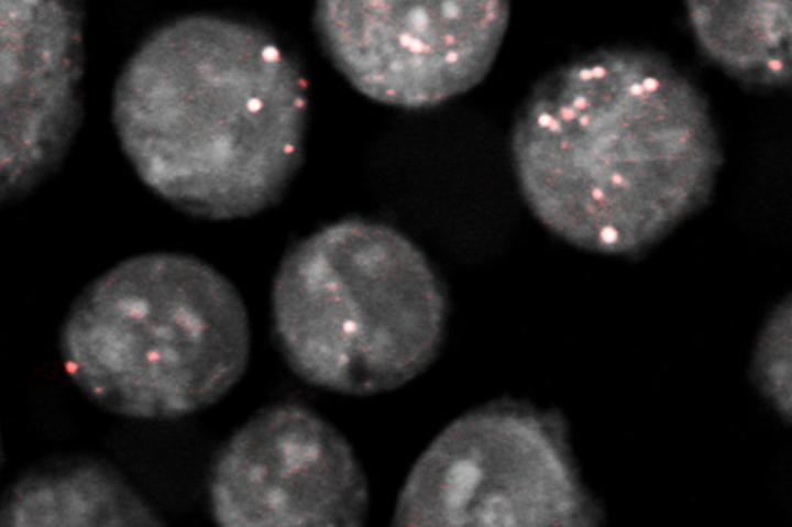 Cancer Cells