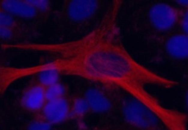 Inducing Neuronal Differentiation using CRISPR/Cas9-MMEJ System